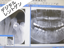 レントゲンで撮影した写真